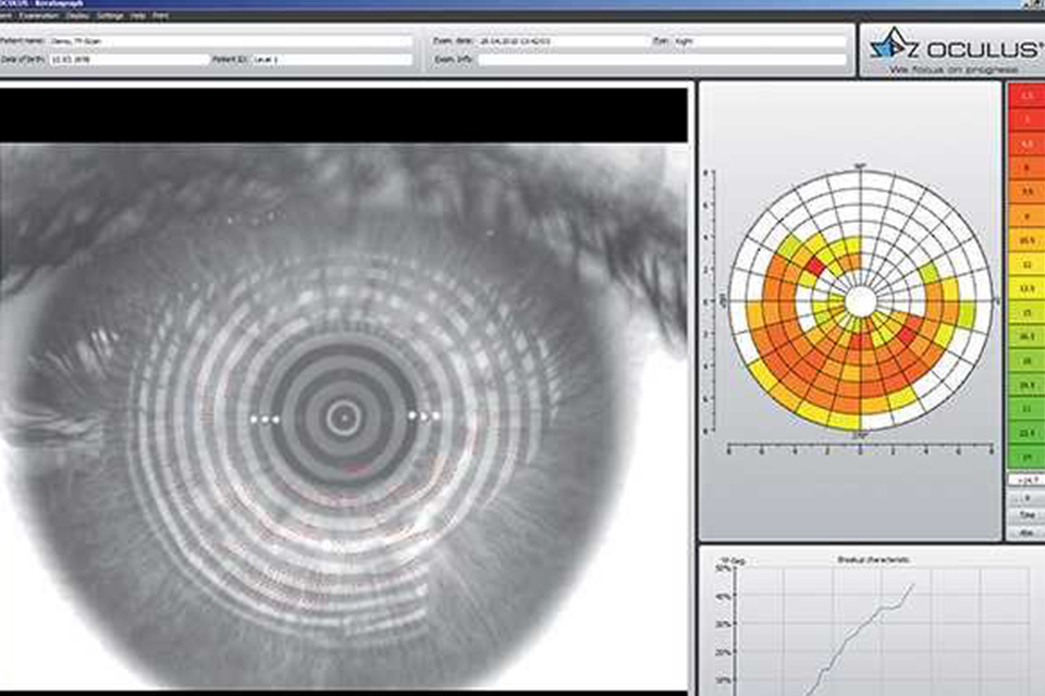 OCULUS Keratograph 5M